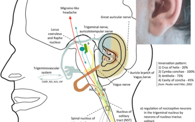 Výskum Daith piercingu – 3.časť