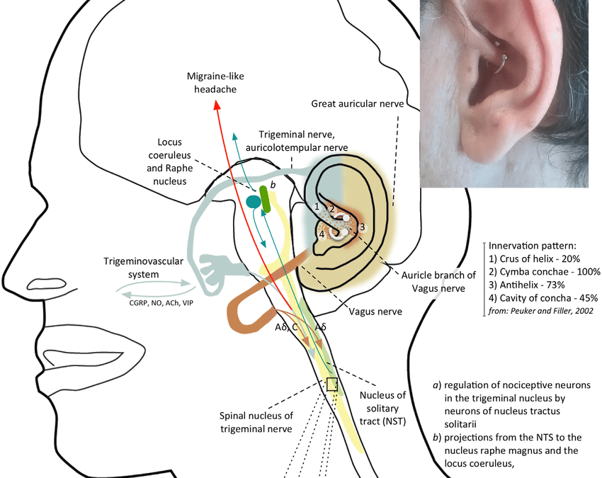 Výskum Daith piercingu – 3.časť